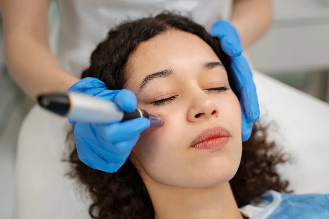 CO2 Laser Resurfacing