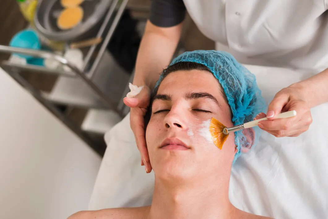 Chemical Peel