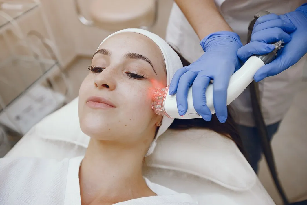 Q-Switch Laser for Pigmentation