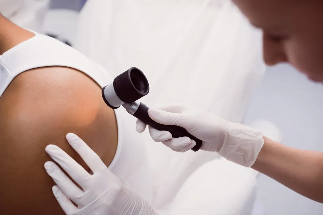 Skin Biopsy